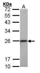 NBP1-33003 - Transgelin (TAGLN)