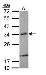 NBP1-33010 - Beta-crystallin A3