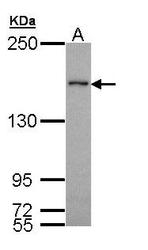 NBP1-33013 - WHSC1L1 / NSD3