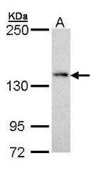 NBP1-33029 - LRP6