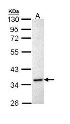 NBP1-33030 - Inhibin alpha / INHA