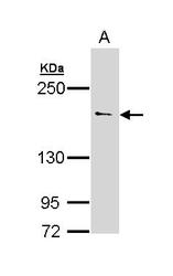 NBP1-33037 - UNC13B