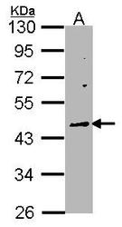 NBP1-33039 - WNT10A