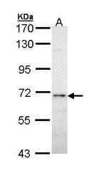 NBP1-33041 - PPP3CA / Calcineurin A