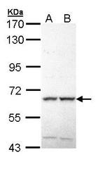 NBP1-33049 - YSK4