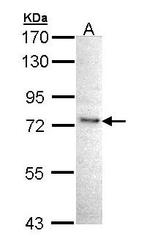 NBP1-33052 - IKBKE / IKKE