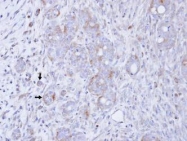 NBP1-33055 - DAG kinase gamma