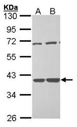 NBP1-33070 - TSTA3
