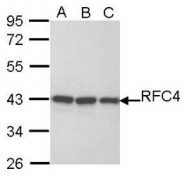 NBP1-33083 - RFC4 / RFC37