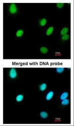 NBP1-33083 - RFC4 / RFC37
