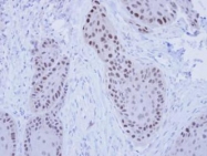 NBP1-33083 - RFC4 / RFC37