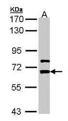 NBP1-33087 - LGI1 / EPT