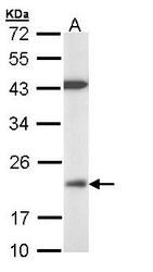 NBP1-33099 - DUSP3