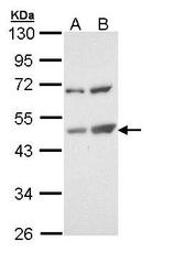 NBP1-33107 - TSPYL1 / TSPYL