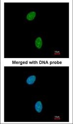 NBP1-33107 - TSPYL1 / TSPYL