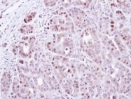 NBP1-33107 - TSPYL1 / TSPYL