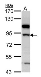 NBP1-33192 - 17-beta-HSD4 / HSD17B4