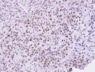 NBP1-33415 - ZHX2
