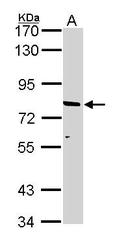 NBP1-33435 - ABCD2 / ALDR