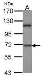 NBP1-33464 - DYRK1B