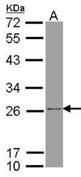 NBP1-33465 - ATP5F1