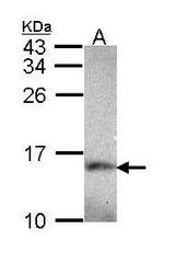 NBP1-33504 - NDUFA5