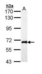 NBP1-33506 - WEE1 / Wee1-like protein kinase