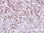 NBP1-33506 - WEE1 / Wee1-like protein kinase