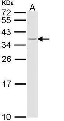NBP1-33525 - HLA class II DR beta 1 / HLA-DRB1