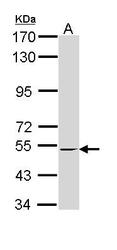 NBP1-33543 - RXR-beta / RXRB