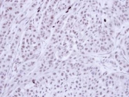 NBP1-33558 - BUB3