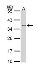 NBP1-33565 - ABO