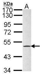 NBP1-33582 - Fibrinogen