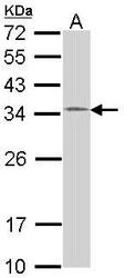 NBP1-33589 - HUS1