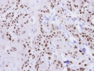 NBP1-33589 - HUS1