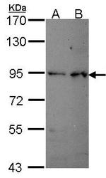 NBP1-33637 - PDE4B