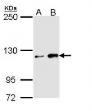 NBP1-33658 - HIPK1