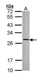 NBP1-33666 - HLA class II DR beta 3 / HLA-DRB3