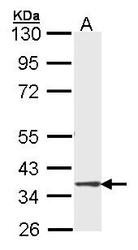 NBP1-33688 - DMC1 / LIM15