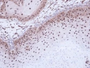 NBP1-33688 - DMC1 / LIM15