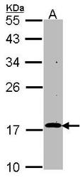 NBP1-33694 - RGS17