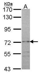NBP1-33710 - RAP1GAP