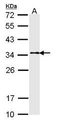 NBP1-33716 - Tropomyosin-1 (TPM1)