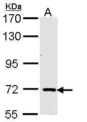 NBP1-33737 - TRIM32 / HT2A