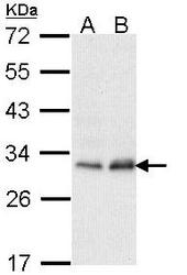 NBP1-33750 - PMM2