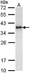 NBP1-33755 - BIRC7 / LIVIN