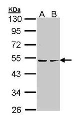 NBP1-33773 - PRKAR2B