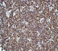 NBP1-40441 - IRF3