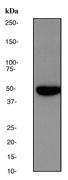 NBP1-40490 - PRKAR2B
