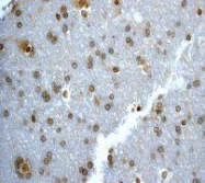 NBP1-40517 - UBC9 / UBE2I